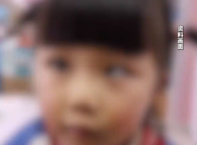 保护下一代视力！远离电子产品！5岁女童沉迷玩手机变“斗鸡眼”