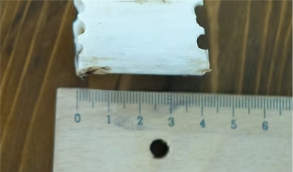 太疯狂!嫌个子太高不好找对象 女子手术切骨变矮