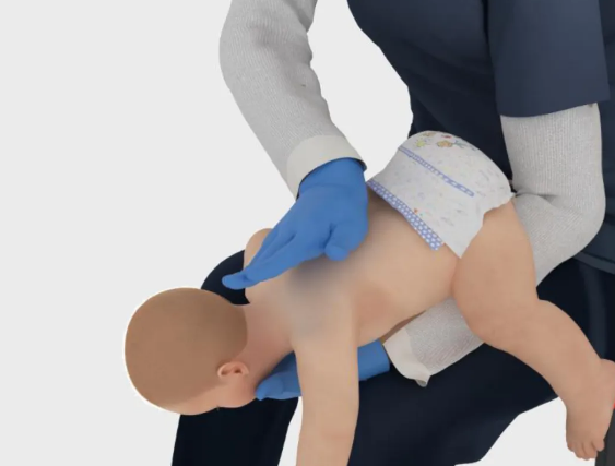 海姆立克急救法更新了:先拍5次背 再做“剪刀石头布” 海姆立克急救法 第1张 海姆立克急救法更新了:先拍5次背 再做“剪刀石头布” 海姆立克急救法 第1张