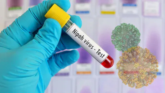 印度这致死率75%的尼帕病毒 真的会成为下一个新冠吗 尼帕病毒 第10张